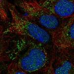 SLC25A18 Polyclonal Antibody
