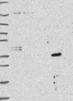 SLC25A18 Antibody in Western Blot (WB)