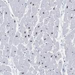 Rbm20 Polyclonal Antibody