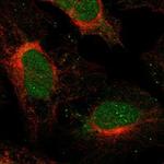 SFMBT2 Polyclonal Antibody