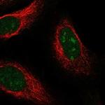 UCK1 Polyclonal Antibody