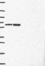 TOR1AIP1 Antibody in Western Blot (WB)