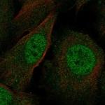 ZMIZ1 Polyclonal Antibody