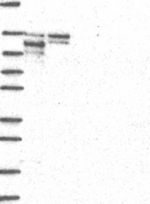 ZMIZ1 Antibody in Western Blot (WB)