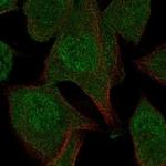 N4BP2 Polyclonal Antibody