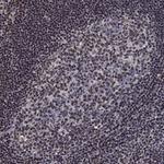 N4BP2 Antibody in Immunohistochemistry (Paraffin) (IHC (P))