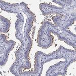 ERICH3 Antibody in Immunohistochemistry (Paraffin) (IHC (P))
