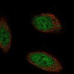 TMEM267 Polyclonal Antibody