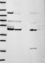 TIMM44 Antibody in Western Blot (WB)