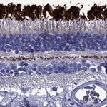 ROM1 Polyclonal Antibody