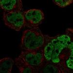 C1orf226 Polyclonal Antibody