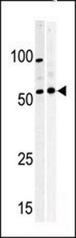 PKMYT1 Polyclonal Antibody