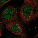 ANKRD40 Polyclonal Antibody