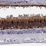 GCAP1 Polyclonal Antibody