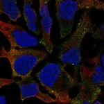 GALNT16 Polyclonal Antibody