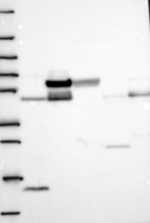 GALNT16 Antibody in Western Blot (WB)