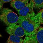 ZBTB45 Polyclonal Antibody