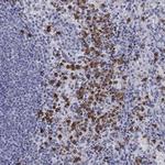 IGSF8 Polyclonal Antibody