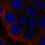 RAB40B Polyclonal Antibody