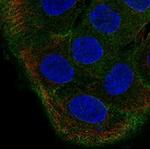 TBC1D2 Polyclonal Antibody