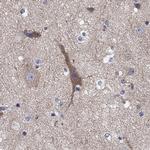 Clavesin-1 Polyclonal Antibody