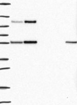 C9orf75 Antibody in Western Blot (WB)