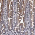 UNC5B Polyclonal Antibody