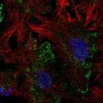 LHFPL2 Polyclonal Antibody