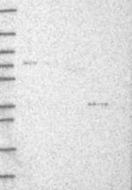DHRS1 Antibody in Western Blot (WB)