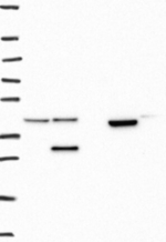 UBXN1 Antibody in Western Blot (WB)