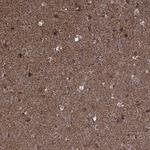 MAP1 Polyclonal Antibody