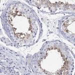 SPATA9 Polyclonal Antibody