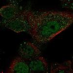 GAL3ST1 Polyclonal Antibody