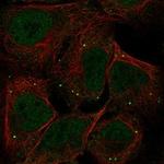 GDE1 Polyclonal Antibody