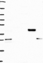 GDE1 Antibody in Western Blot (WB)