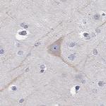 PCDH11X Polyclonal Antibody
