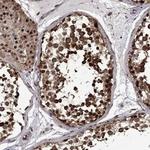 KPNA3 Polyclonal Antibody