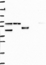 KPNA3 Antibody in Western Blot (WB)