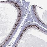 ZNHIT3 Antibody in Immunohistochemistry (Paraffin) (IHC (P))