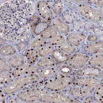 ZNHIT3 Antibody in Immunohistochemistry (Paraffin) (IHC (P))