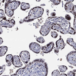 ZNHIT3 Antibody in Immunohistochemistry (Paraffin) (IHC (P))