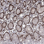 ZNHIT3 Antibody in Immunohistochemistry (Paraffin) (IHC (P))