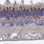 GRK7 Antibody in Immunohistochemistry (Paraffin) (IHC (P))