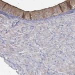 EMILIN3 Polyclonal Antibody