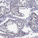 C19orf18 Antibody in Immunohistochemistry (Paraffin) (IHC (P))
