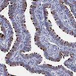 DNALI1 Antibody in Immunohistochemistry (Paraffin) (IHC (P))