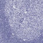 DNALI1 Antibody in Immunohistochemistry (Paraffin) (IHC (P))