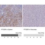 PTGDR Polyclonal Antibody