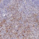 PTGDR Antibody in Immunohistochemistry (Paraffin) (IHC (P))