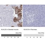 KLHL33 Antibody in Immunohistochemistry (Paraffin) (IHC (P))
